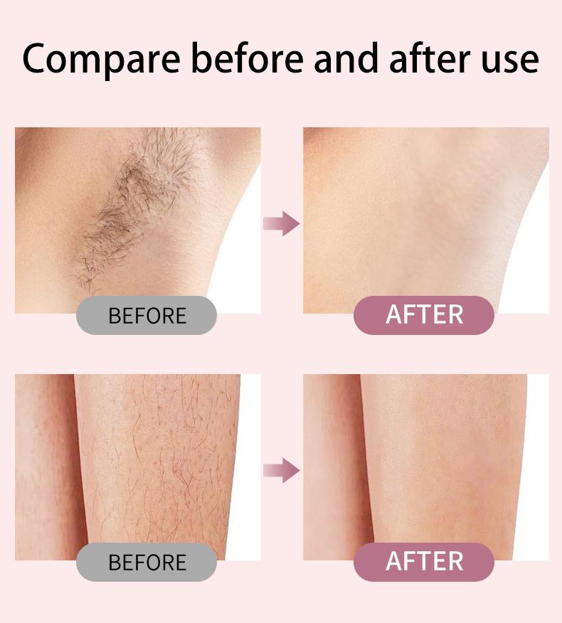 Bikini Trimmer for Women Electric Razors for Women Women's Electric Razor 2 in 1 Shaver Pubic Hair Trimmer waxing kit Ipx7 Waterproof Wet Dry Use Bikini Shaver for Ladies Pubic, Legs, Face, Underarms Pink Bikini Trimmer for Women Electric Razors for Women Women's Electric Razor 2 in 1 Shaver Pubic Hair Trimmer waxing kit Ipx7 Waterproof Wet Dry Use Bikini Shaver for Ladies Pubic, Legs, Face, Underarms Pink
