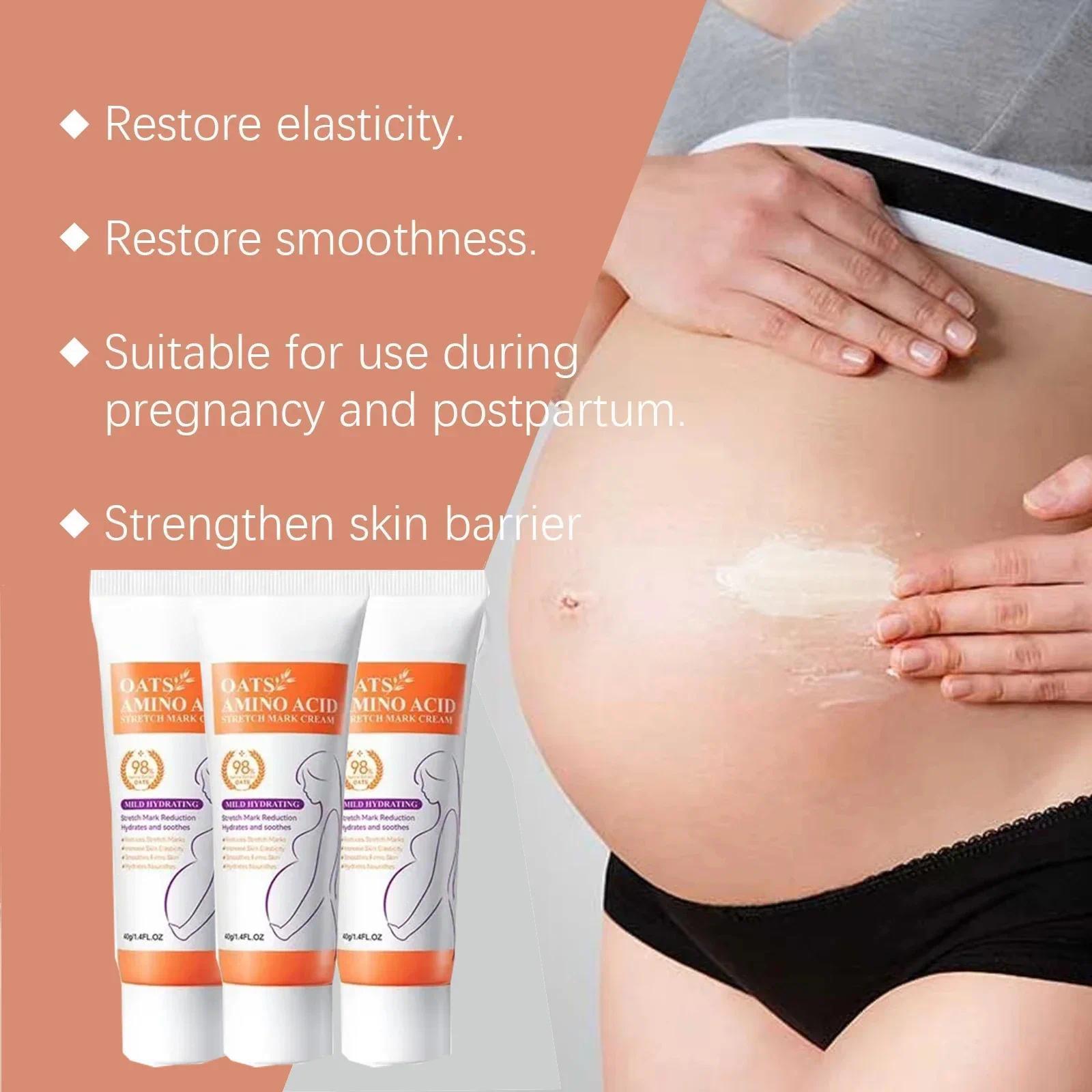 HOT SALE Stretch Marks Permanent Removal Eliminate Body Belly Stretch Marks Swelling Marks Remove Skin Cracks Repair Firming Car
