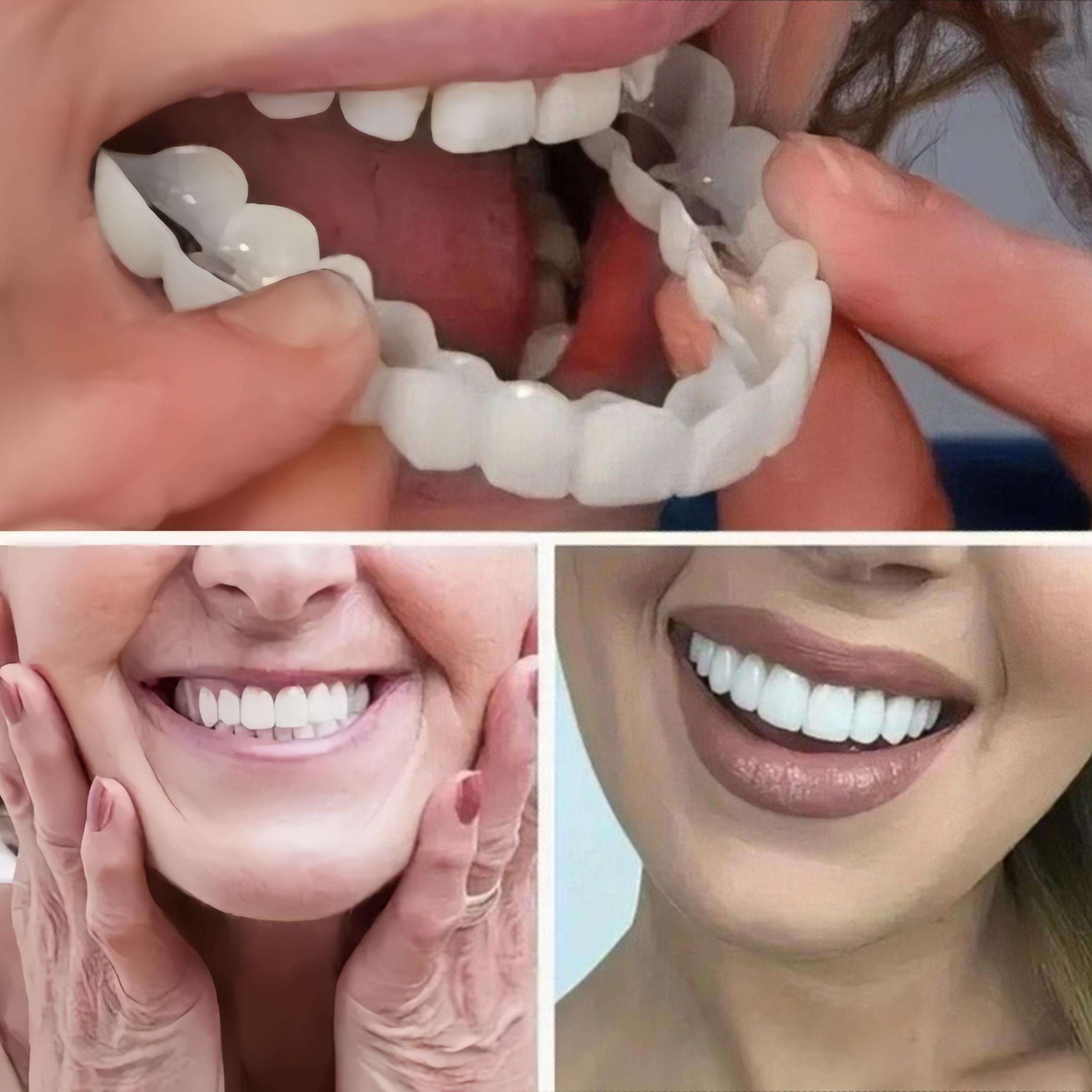 Comfortable False Teeth Aligners Pack of 2, Durable Adjustable Easy Clean Stain Resistant, Perfect Fit Daily Wear Dental Care, Mouthpiece