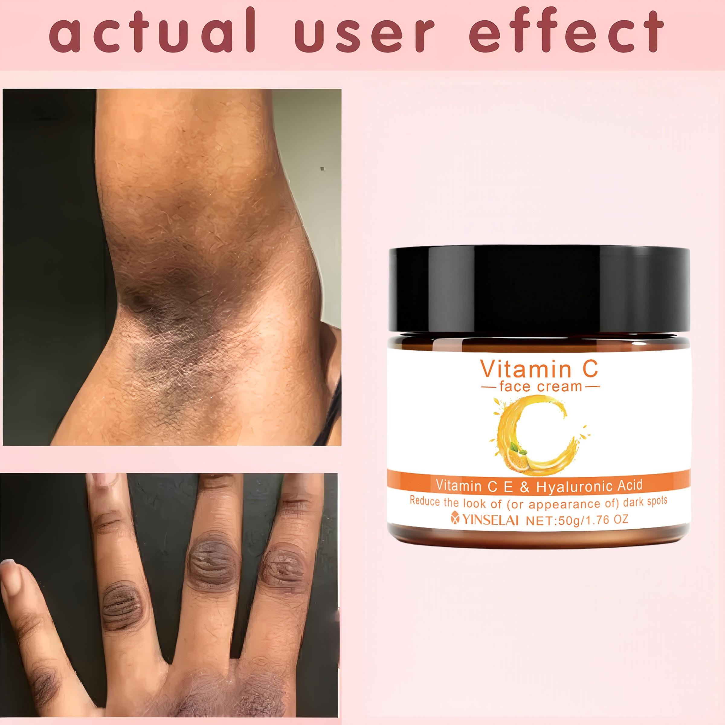 50g Vitamin C Cream, 3-Day Care, 2-Minute Absorption, Moisturizing Lotion for Underarms, Knees, Bikini Line, Neck, Collagen, Hyaluronic Acid, Niacinamide