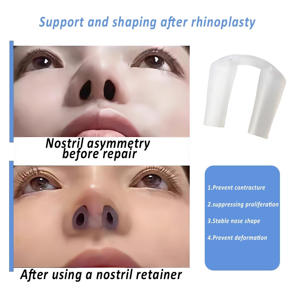 Nostril Retainer,Nose Clip for Rhinoplasty Recovery , Nose Retainer for Surgery ,Nose Shaper & Support Device , Silicone , Post-Surgery Nostril Shaping & Recovery Aid,7 Sizes
