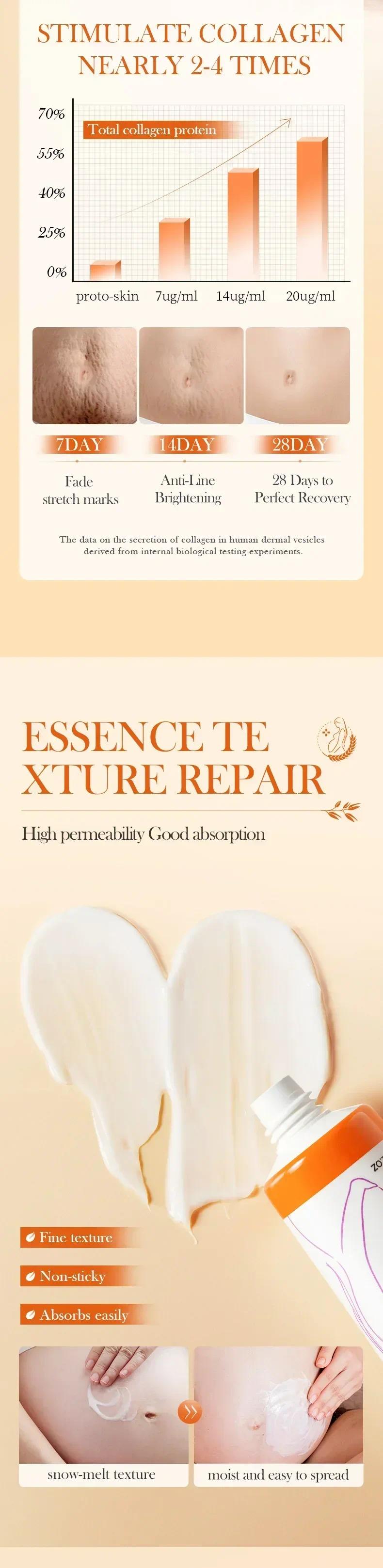 HOT SALE Stretch Marks Permanent Removal Eliminate Body Belly Stretch Marks Swelling Marks Remove Skin Cracks Repair Firming Car