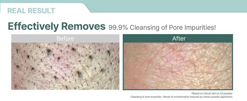 Sensitive Skincare Trio (Facial Cleanser, Milky Toner, Cream) | Hypoallergenic & Gentle on Sensitive Skin, Instant Hydration, Vegan Moisturizers for All Skin Types (8.45 fl.oz + 8.45 fl.oz + 6.76 fl.oz)