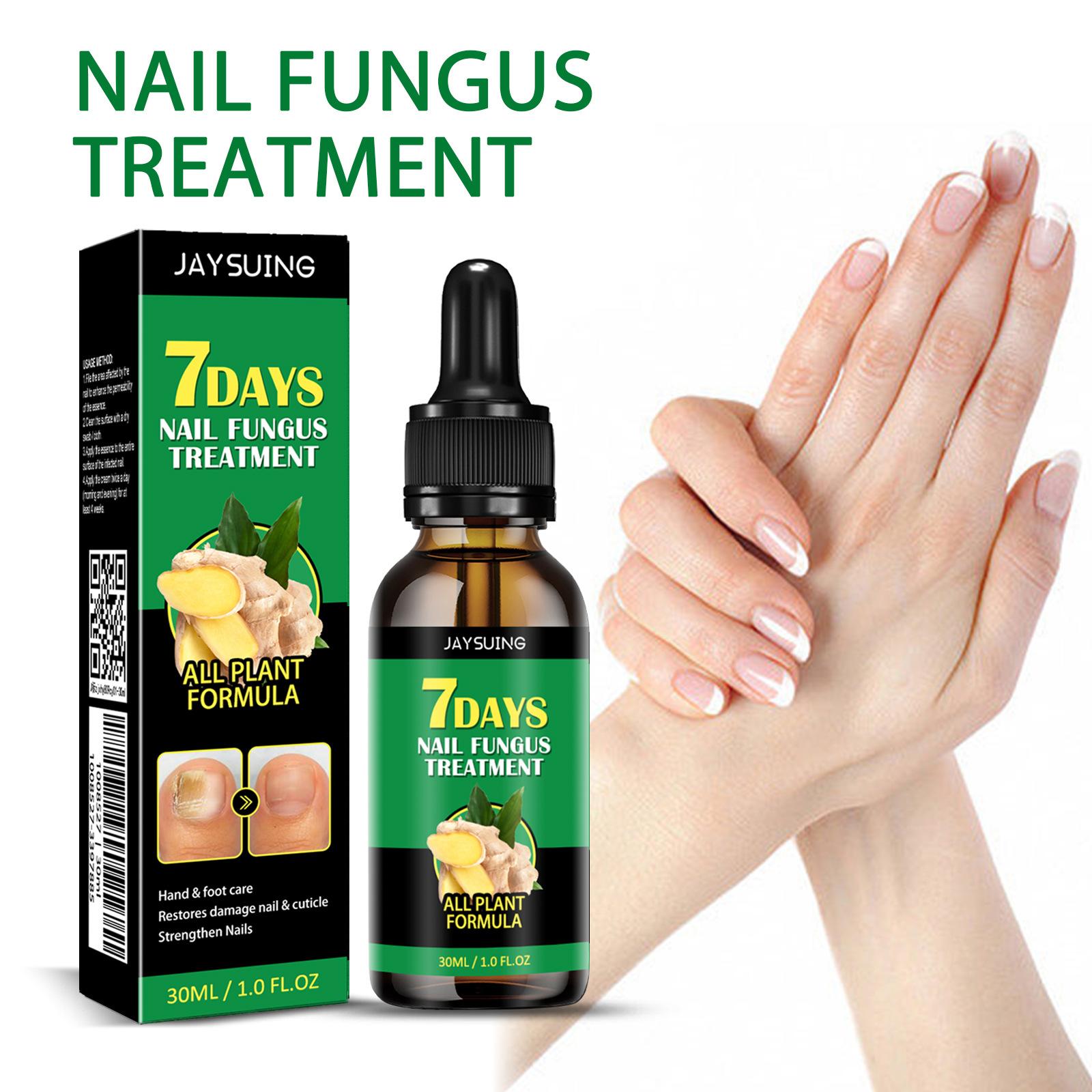 JAYSUING Ginger Nail Treatment | Vitamin E & Plant Essential Oils for Nail Care | Supports Recovery from Onychomycosis, Paronychia, & Nail Deformation | Nail Nutrient Strengthener Oil - Ginger Cuticle Care Oil for Nails