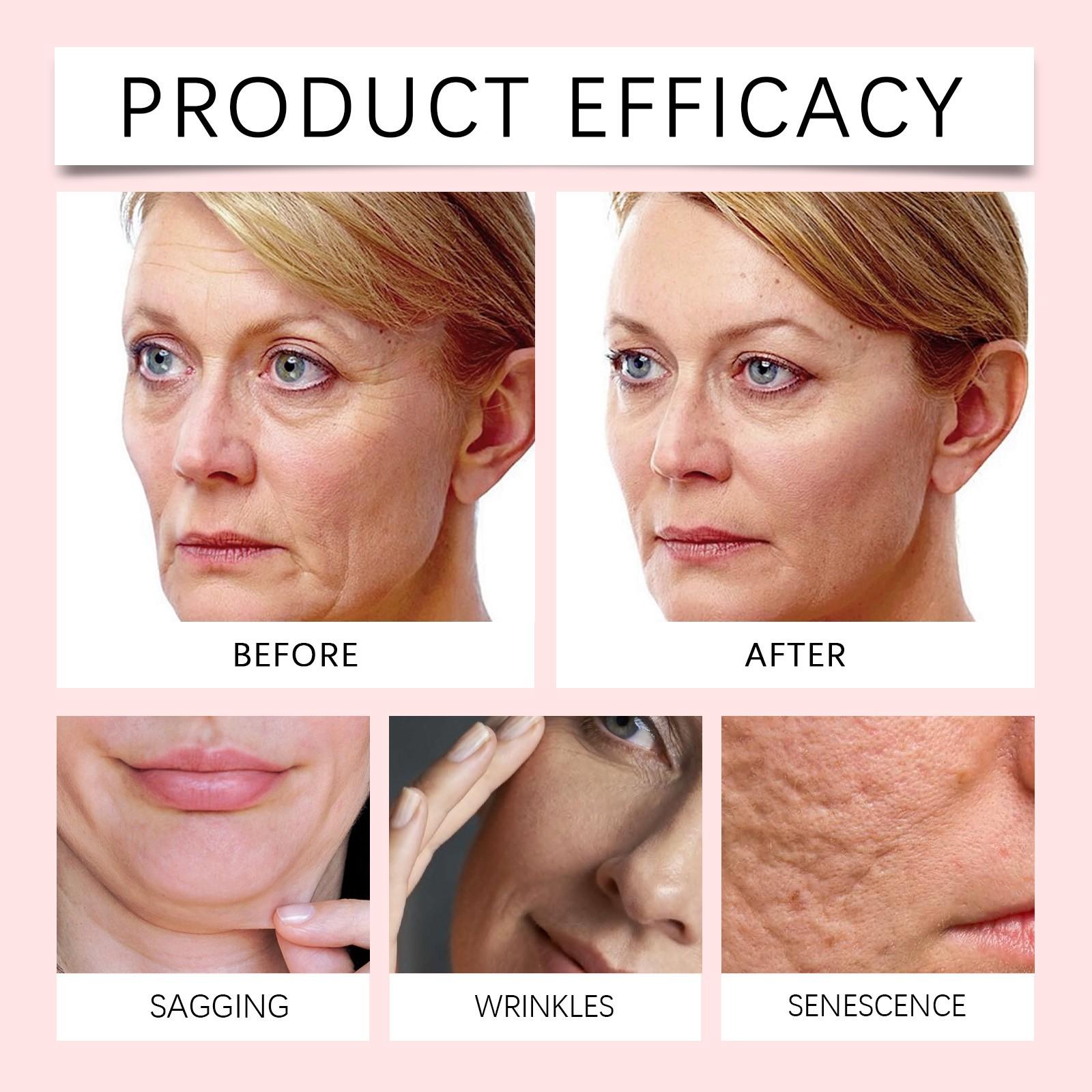 Ouhoe Moisturizing Face Cream, Reduces Fine Lines, Brightens Skin Tone, Hydrates and Smooths Skin, Improves Skin Texture, Non-Greasy