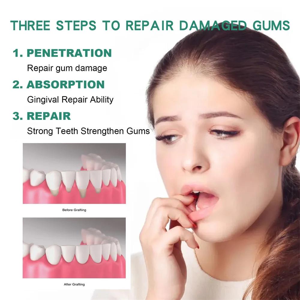 Gum Repair Drops Relieve Receding Gingival Swelling Gum Cleaning Care Oral Periodontal Hygiene Remove Yellow Remove Stain Gum Repair Drops Relieve Receding Gingival Swelling Gum Cleaning Care Oral Periodontal Hygiene Remove Yellow Remove Stain