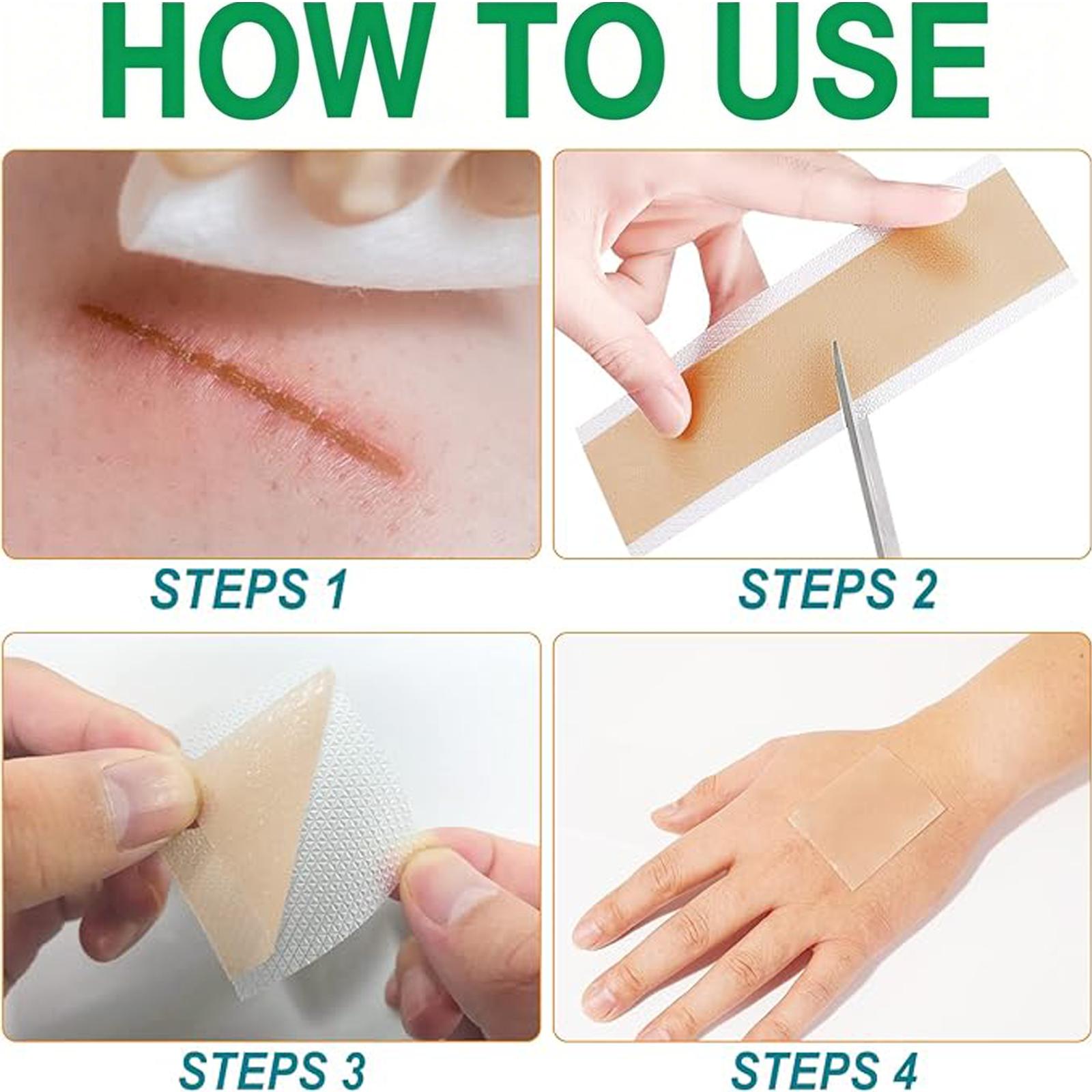 Suitable for All Skin Types,Reusable Silicone Scar Tape Strips Type for Keloid,Professional Silicone Scar Sheets,Burn, Acne Et.