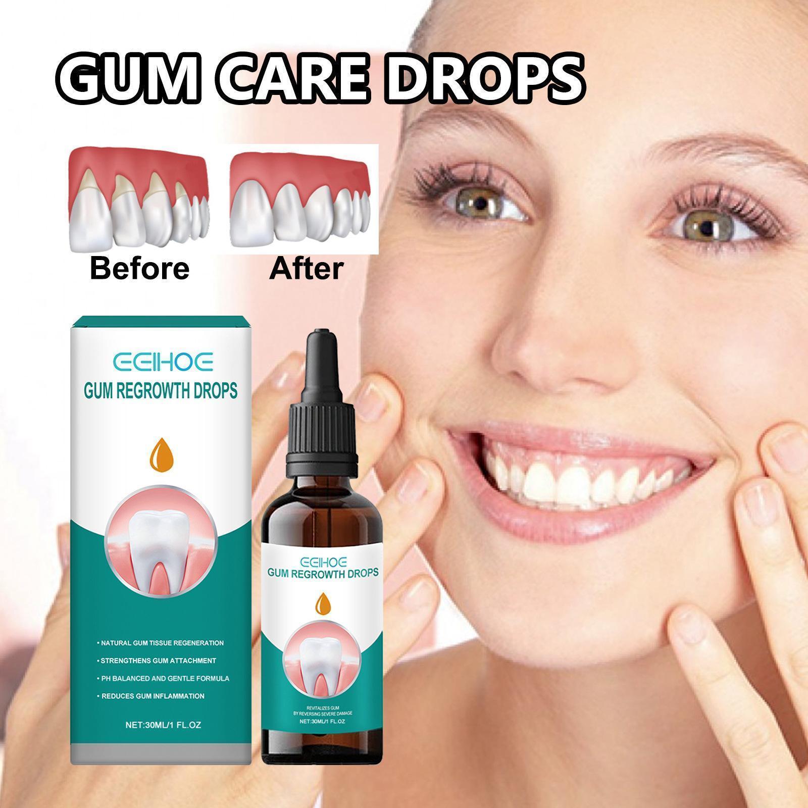 Rapid Repair Gums Serum Effectively Relieve Tooth Allergy Dental Caries Tooth Cleaning Toothpaste Relieve Tooth Damage Drops