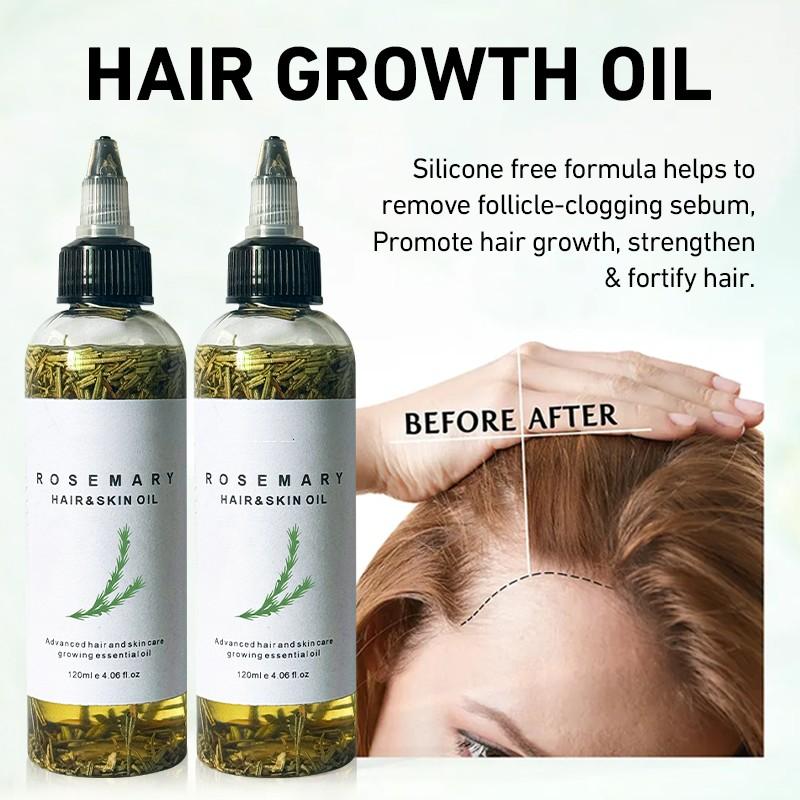 LANYAN 120ML Scalp Stimulating Hair Growth Oil, Light Mint & Peppermint Blend, Promotes Fuller Thicker Hair, Supports Hair Loss Repair