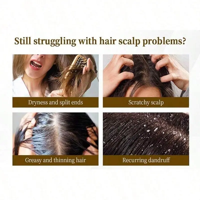 Efficient Dandruff Comb, Dandruff Remover Comb for Women Men - Scalp Massage Comb with Scalp Stimulation and Self-Cleaning Hollow Teeth for Cleaning, Deep Oil & Flake Removal, Anti-Buildup Scalp Care for Healthy Hair & Itchy Scalp Relief, Hair Care Tool