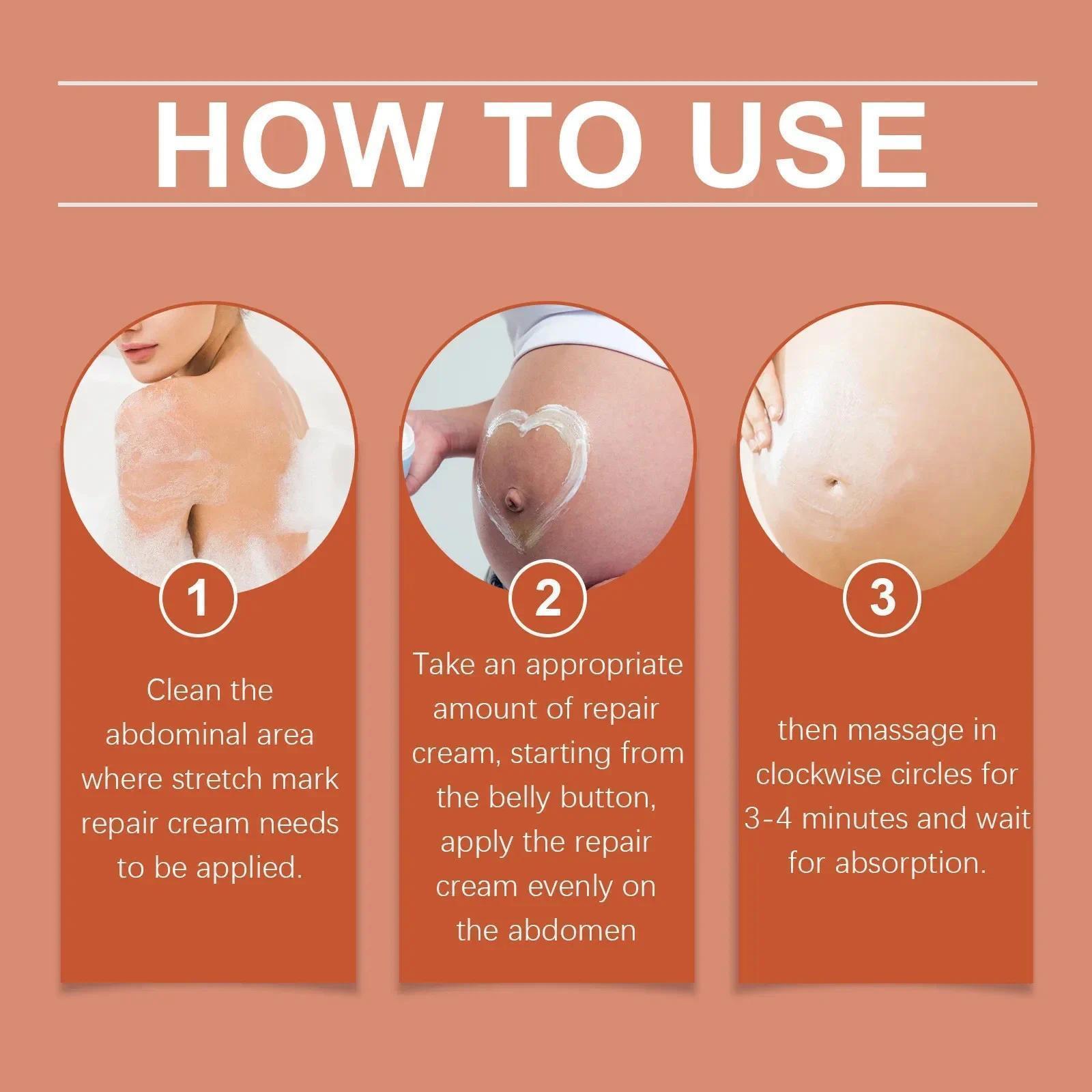 HOT SALE Stretch Marks Permanent Removal Eliminate Body Belly Stretch Marks Swelling Marks Remove Skin Cracks Repair Firming Car