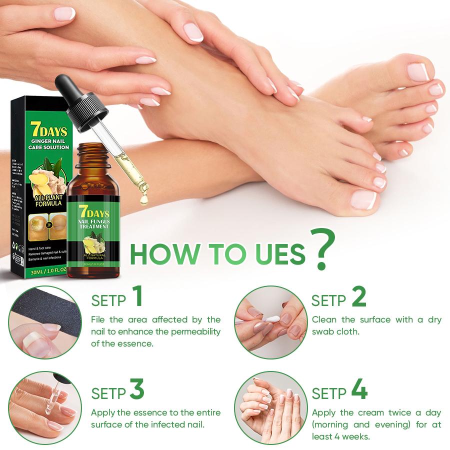 SWEASTH 7 Days Ginger Nail Care Solution - 30ml Nail Growth Oil for Onychomycosis Treatment & Nail Repair - Alleviates Yellowing & Thickening - All Plant Formula - Manicure Essential - Repairing