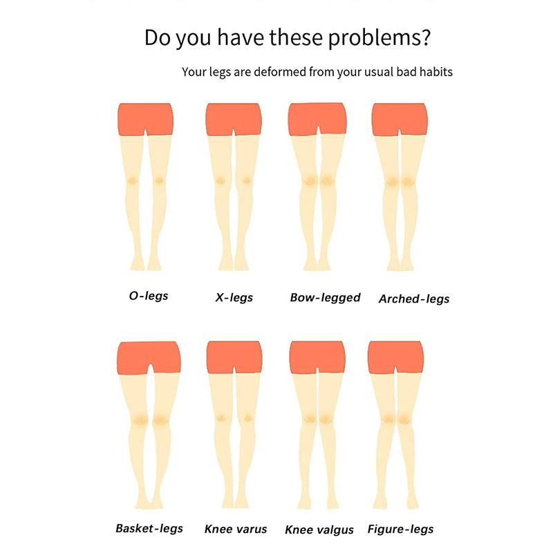 Leg Correction Belt 3 In 1 Leg Corrector Bandage  O Or X Adjustable Leg Posture Correction Belt Bow Leg Corrector Inside Eight Character Corrector Leggings Belt Knock Knee Braces