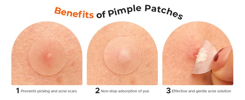 TKTK 609 Count Pimple Patches for Face, Hydrocolloid Acne Patch Bulk, Acne Stickers for Covering Cheeks, Forehead, Chin Blemishes Zit Breakouts for All Skin Types (Dots, Strip, Contoured 5 Sizes)