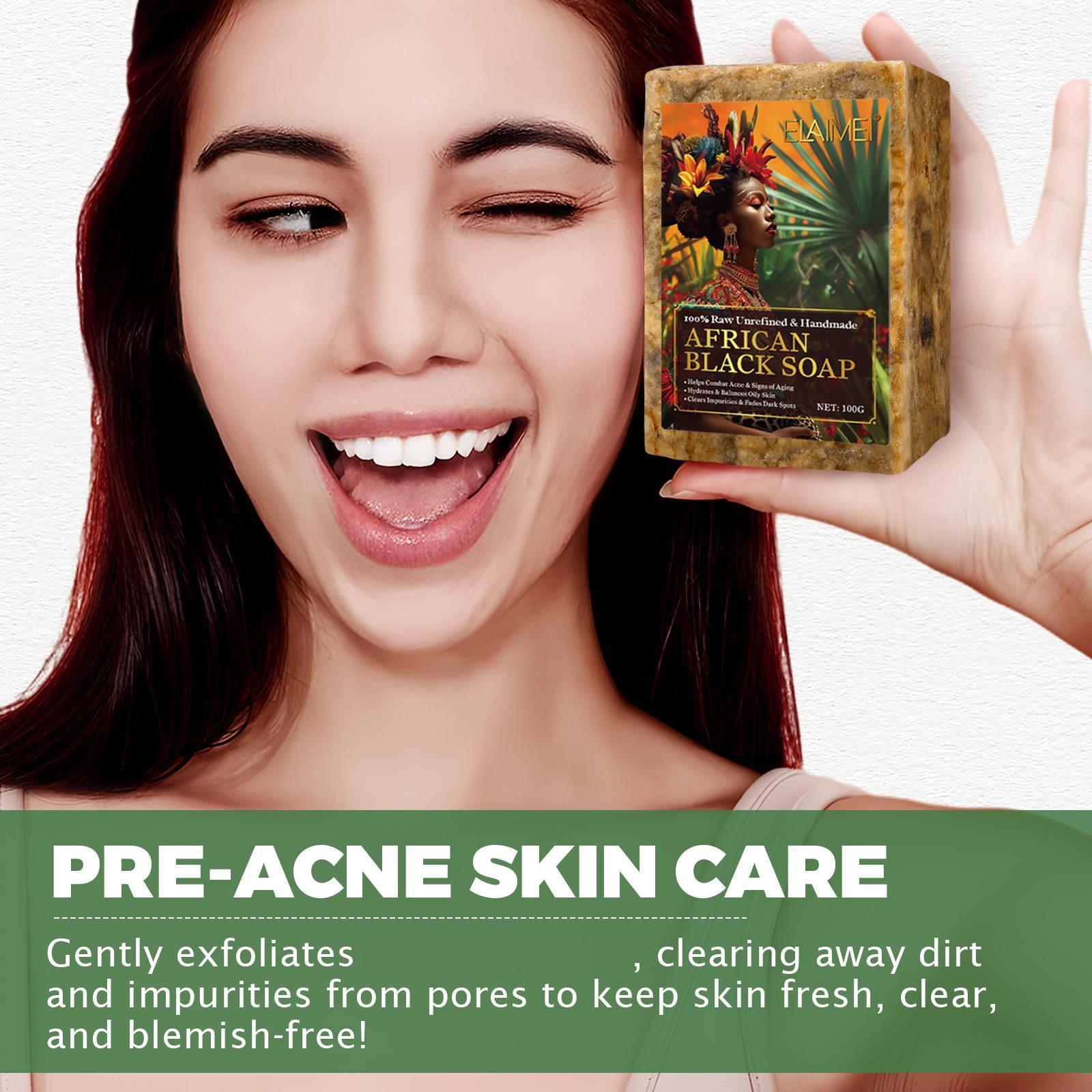 ELAIMEl African Black Soap, comes with a lathering net, produces a rich, creamy lather, gently removes oil from the skin, and leaves it feeling fresh and clean. Bath soap.