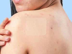 LitBear Skincare Large Pimple Patches 7 Sizes 306 Patches, Acne Spot Treatment XL Hydrocolloid Bandages for Full Face, Forehead,Back and Body Skincare