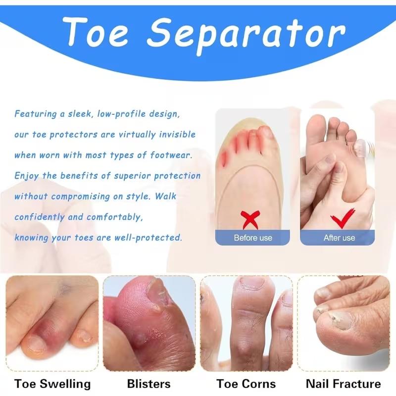 10pcs Silicone Anti-Friction Toe Covers, Breathable Gel Toe Protectors, Unisex Foot Care Accessories, Reusable Comfortable Silicone Guards