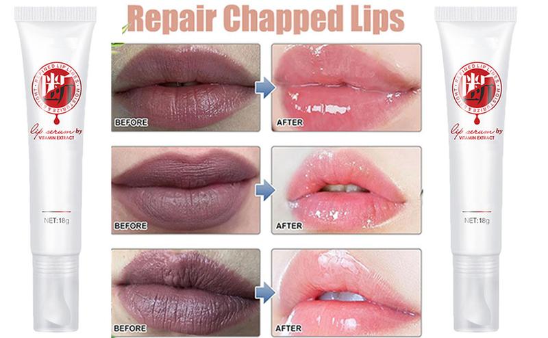 1PC Lips Pink Fresh Treatment Remove Dark Smoke Lips Lip Balm Moisturizer Nourishing Essence 1PC Lips Pink Fresh Treatment Remove Dark Smoke Lips Lip Balm Moisturizer Nourishing Essence