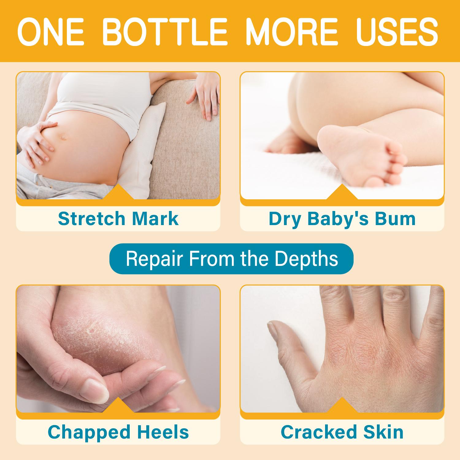 Stretch Mark Butter - Organic Belly Butter for Pregnancy and Nursing - Repair Stretch Marks and Scars - Shea Butter & Vitamin E Rich Formula, Paraben, Phenoxyethanol Free, 3.53 Oz/100g