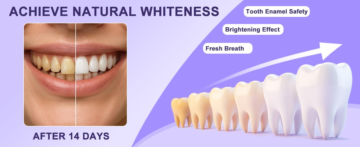 Purple Teeth Whitening Strips – Peroxide-Free & Enamel Safe for Sensitive Teeth, Purple Tooth Whitening, Remove Coffee/Tea/Wine Stains, Combining Whitening Colour Correction, Natural Color Enhancement for Brighter Smile, Daily & Travel Use Oral Gentle Kit Purple Teeth Whitening Strips – Peroxide-Free & Enamel Safe for Sensitive Teeth, Purple Tooth Whitening, Remove Coffee/Tea/Wine Stains, Combining Whitening Colour Correction, Natural Color Enhancement for Brighter Smile, Daily & Travel Use Oral Gentle Kit