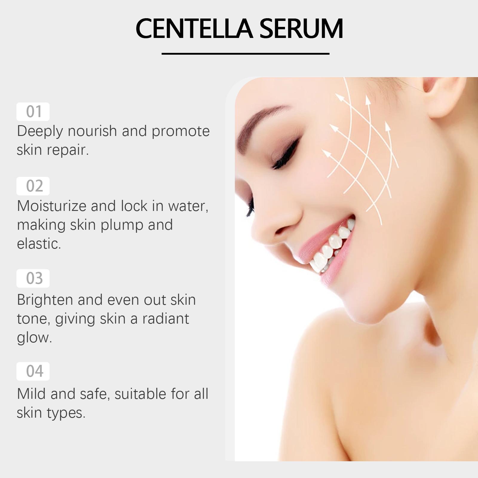 Centella Asiatica Serum (50ML), Natural Ingredients, Tightening & Hydrating, Reduces Acne, Smooths Skin, Daily Facial Care Essence