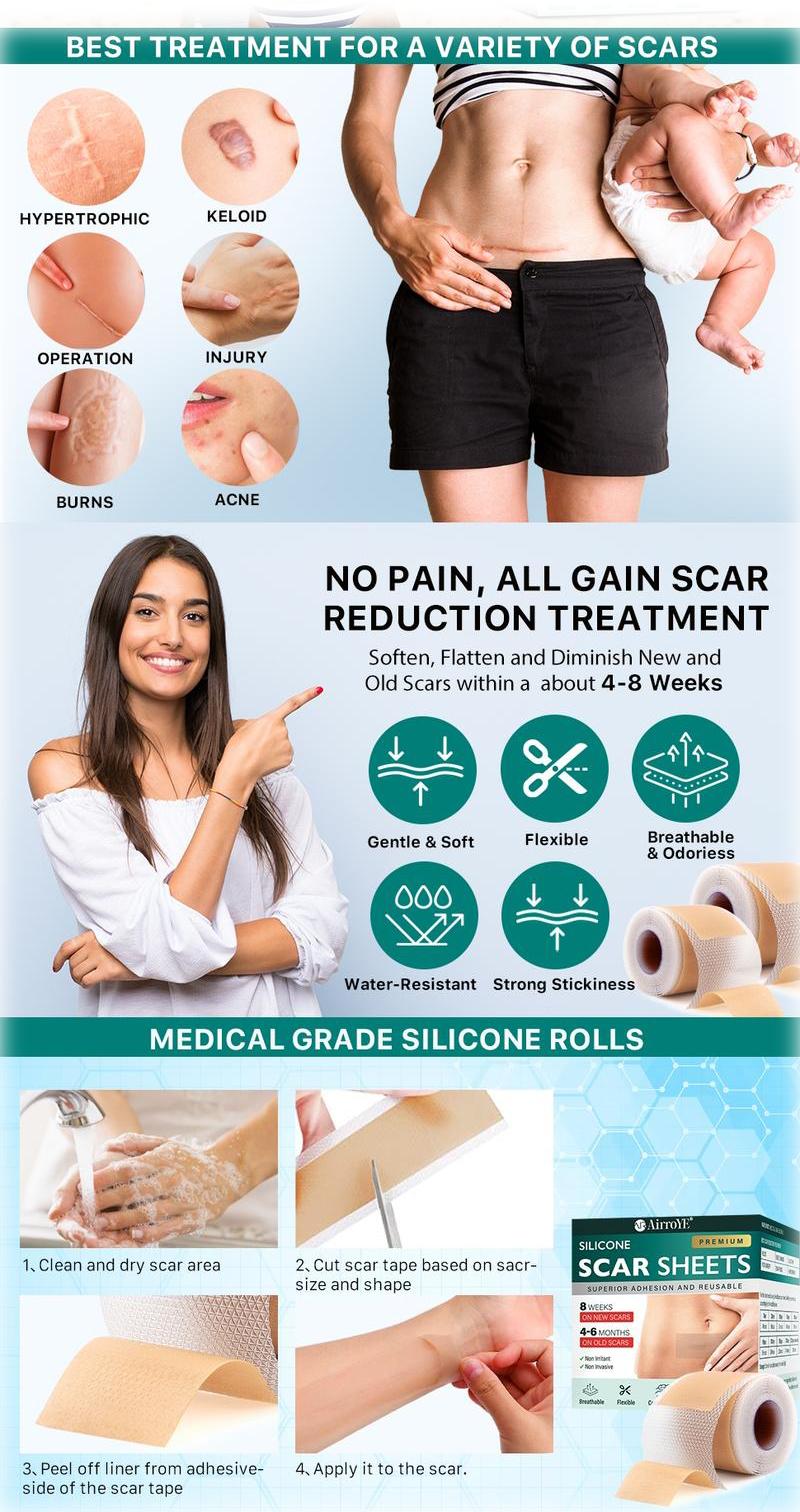 Professional Silicone Scar Sheets,Reusable Silicone Scar Tape Strips Type for Keloid,Burn, Acne Et,Reusable.smartliving