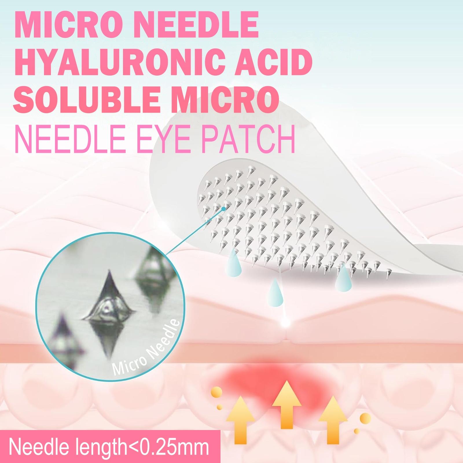 2pcs Hyaluronic Acid Micro Needle Eye Mask, Injected Retinol & Peptides, for Eyes Face Nose, Strong Moisture Tightening Glow