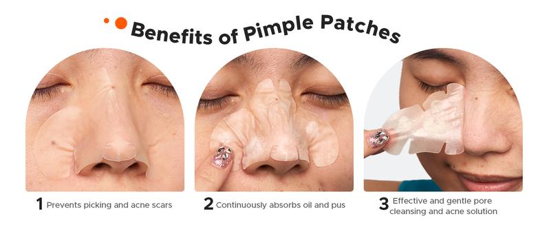 TKTK Hydrocolloid Nose Patches, XL Nose Pore Strips 91 x 48 mm, Large Hydrocolloid Acne Pimple Patches for Face, Cover Zit Blemishes & Absorb Oil (Nose Contoured, Strip, Dots 5 Sizes 112 Count) acne clearing products #TikTokShopBlackFriday TKTK Hydrocolloid Nose Patches, XL Nose Pore Strips 91 x 48 mm, Large Hydrocolloid Acne Pimple Patches for Face, Cover Zit Blemishes & Absorb Oil (Nose Contoured, Strip, Dots 5 Sizes 112 Count) acne clearing products #TikTokShopBlackFriday