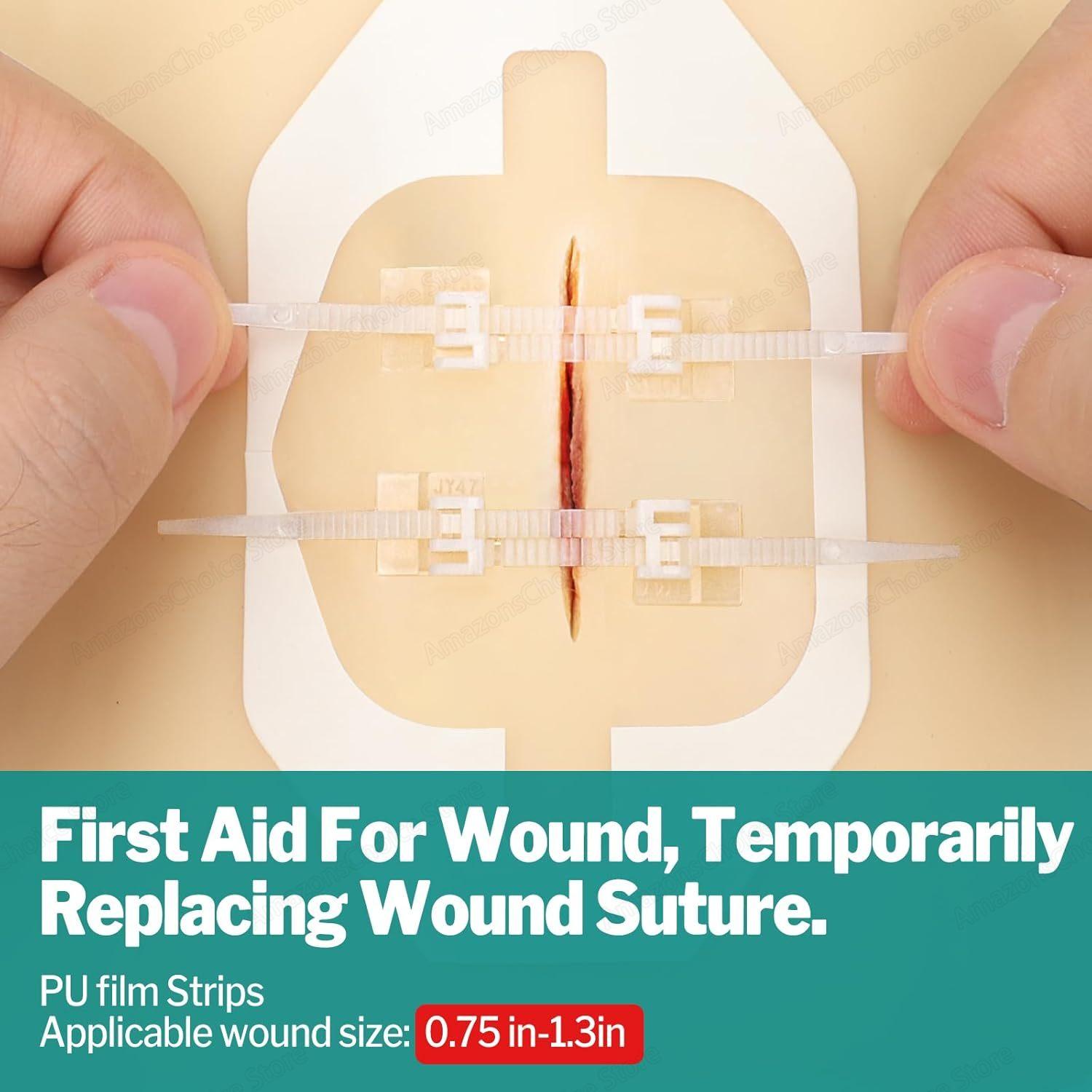 Sanke Rescue 14/28 Pack Wound Closure Strips Zipper Bandages Emergency Laceration Closure Kit Repair Wounds Closures Device