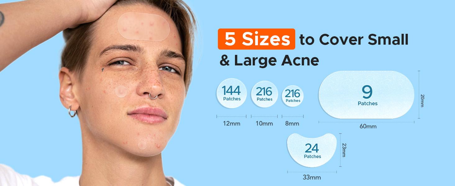 TKTK 609 Count Pimple Patches for Face, Hydrocolloid Acne Patch Bulk, Acne Stickers for Covering Cheeks, Forehead, Chin Blemishes Zit Breakouts for All Skin Types (Dots, Strip, Contoured 5 Sizes) #SpringStatements