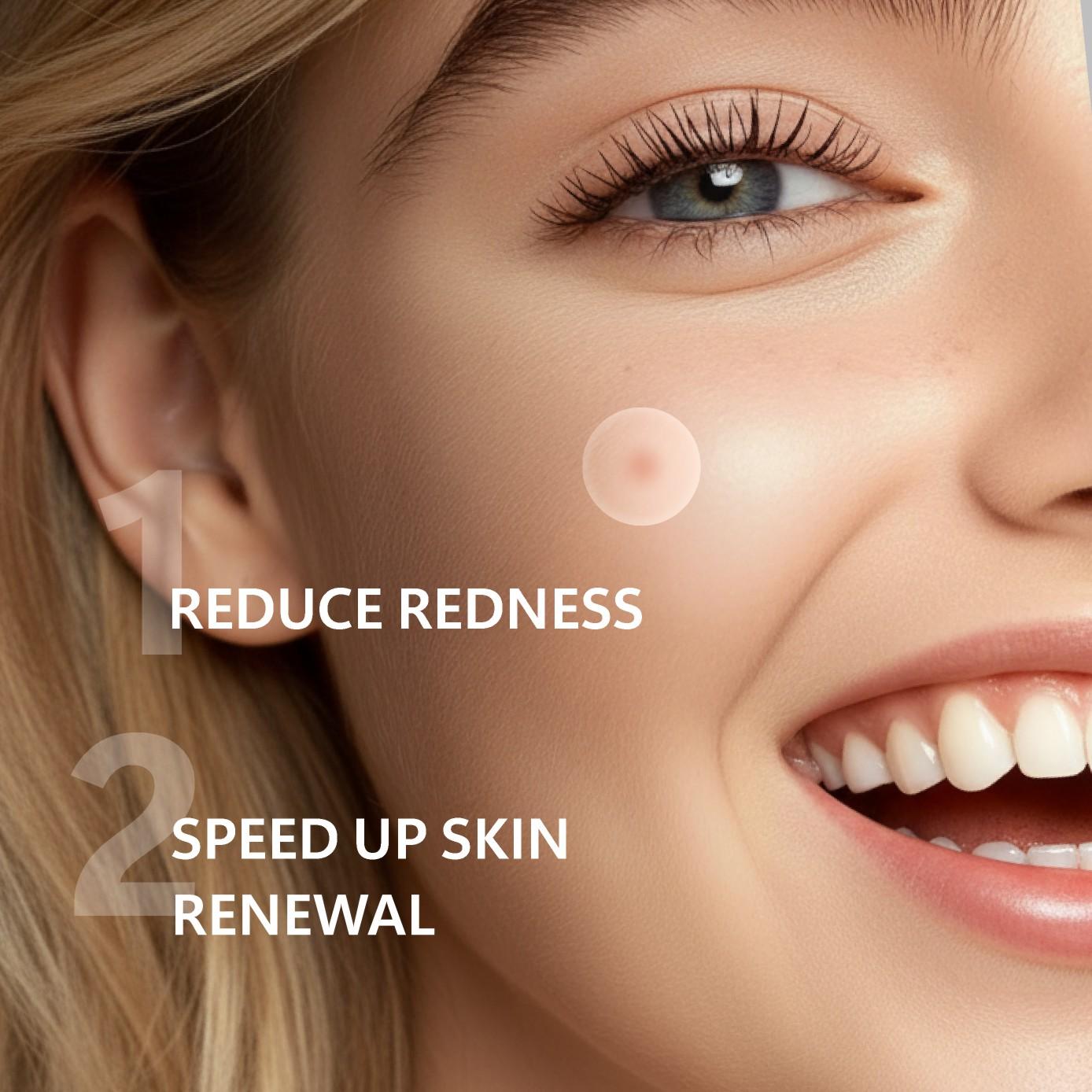 12/24 Pcs Micro Needle Acne Patch, Contains Salicylic Acid Hyaluronic Acid Tea Tree Oil, Single Pack Acne Care, Anti-Acne Treatment