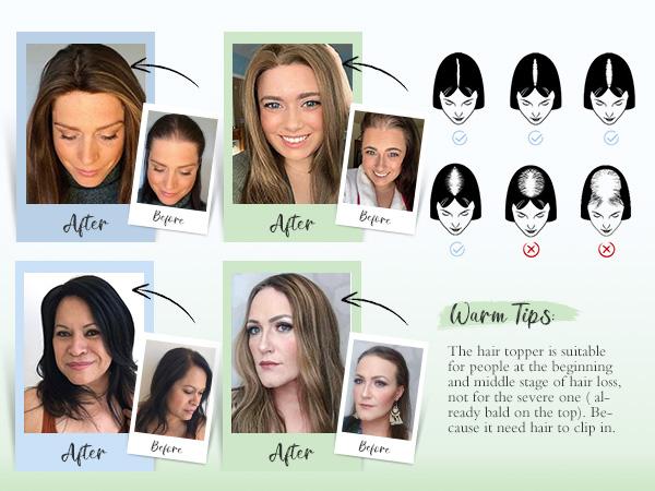 Hair Toppers for Women,Top Hairpieces 100% Remy Human Hair no Bangs,120% Density Swiss Base Clip In Topper 7x10CM 10inch Hair Toppers for Women Real Human Hair,Remy Human with Thinning Upgrade Middle Part Clip in Topper Hair Pieces for Women Daily