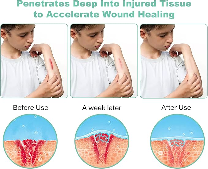 Red Light Therapy Portable Infrared Light Therapy Device for Body Knee, Hand Muscle Joint Pain Relief, Comfort, Face Beauty Instrument