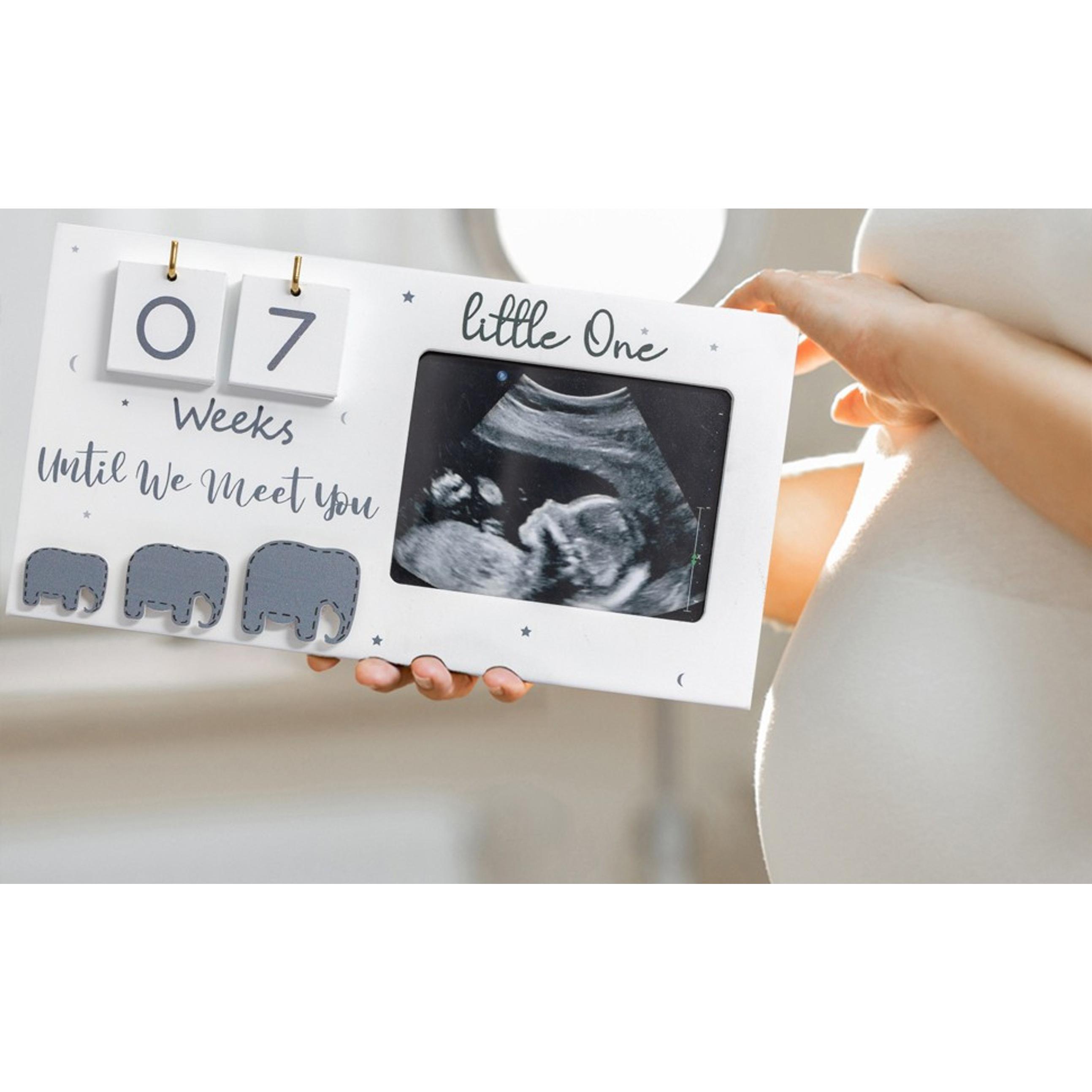 Ultrasound Photo Frame with Baby Countdown Weeks - Pregnancy Keepsake Gift for Expecting Parents, Grandparent Baby Announcement, First Time Mom Must HaveGift Ultrasound Photo Frame with Baby Countdown Weeks - Pregnancy Keepsake Gift for Expecting Parents, Grandparent Baby Announcement, First Time Mom Must HaveGift