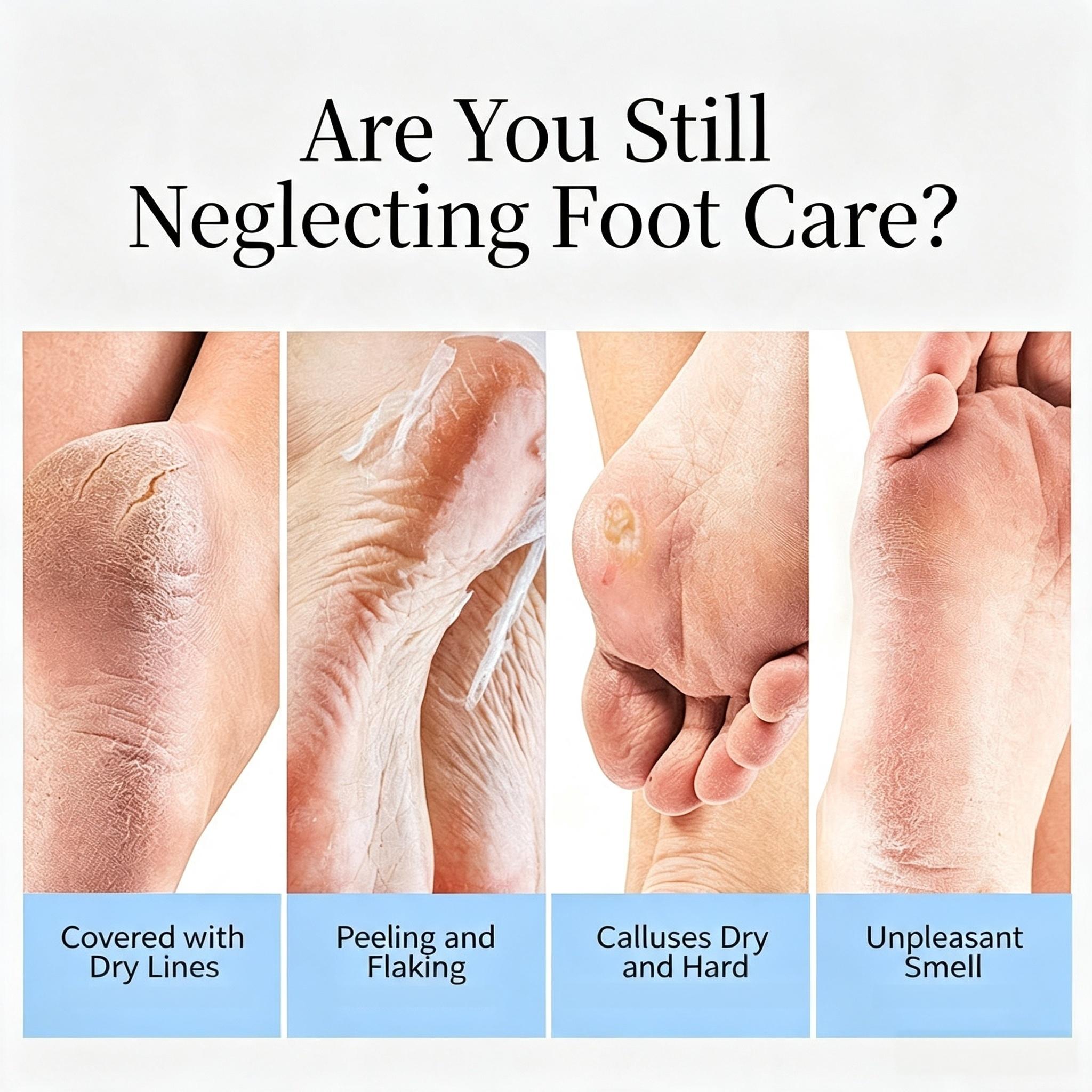 BEEVENOM Foot Cream, Bee Venom Dry Cracked Heel Cream for Dry Feet, Intensive Moisturizing & Exfoliating Foot Care, Softens Calluses & Rough Skin, Deep Hydration Repair for Cracked Heels, Essential Pedicure Treatment for Baby Soft Feet. #Skincare #FootCar