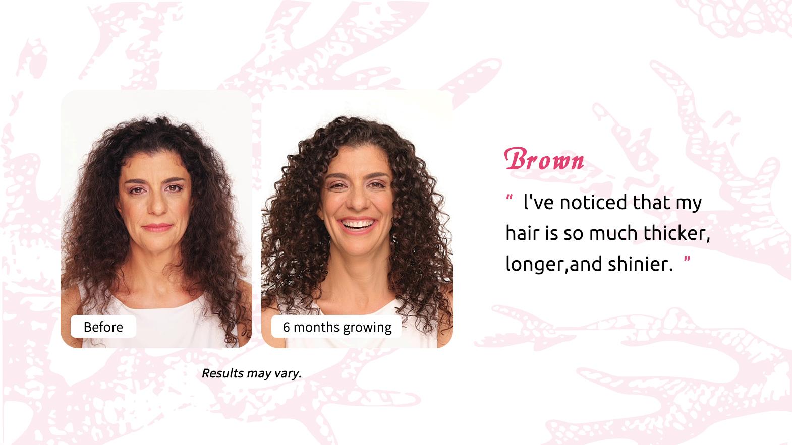 HiPlus Hair Growth Accelerator – Beauty Vitamin Healthcare–For Thicker,Nourishes Thinning&Loss,With Proprietary Collagen Complex, Biotin, Clinically Proven for Visibly Thicker Hair and Scalp Coverage,Dermatologist Recommended 45-Day Supply