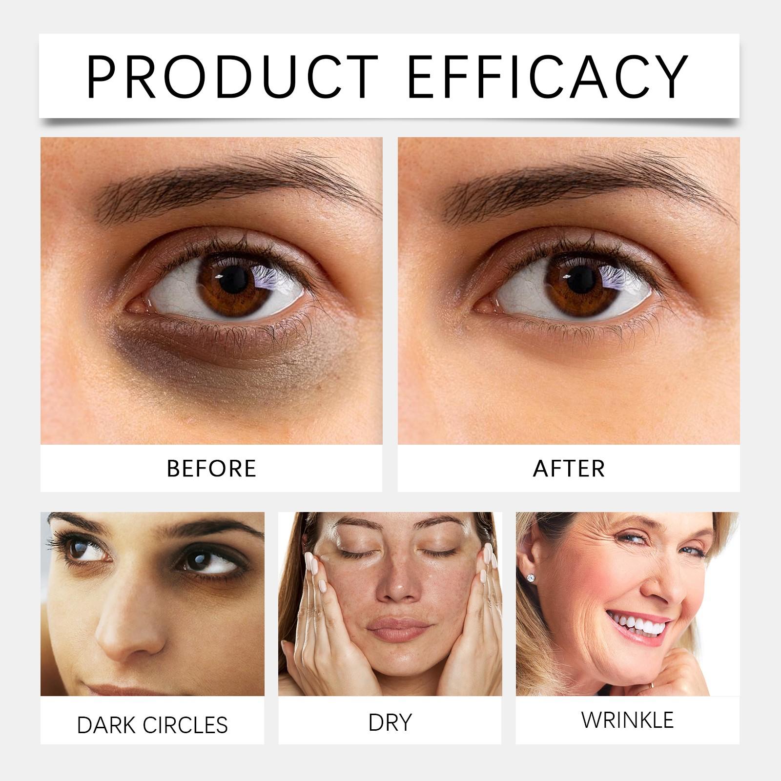 Nourishing Moisturizing Eye Cream, Smooths Fine Lines & Wrinkles, Daily Use for Radiant Eyes, Hydrating Formula for Soft Skin