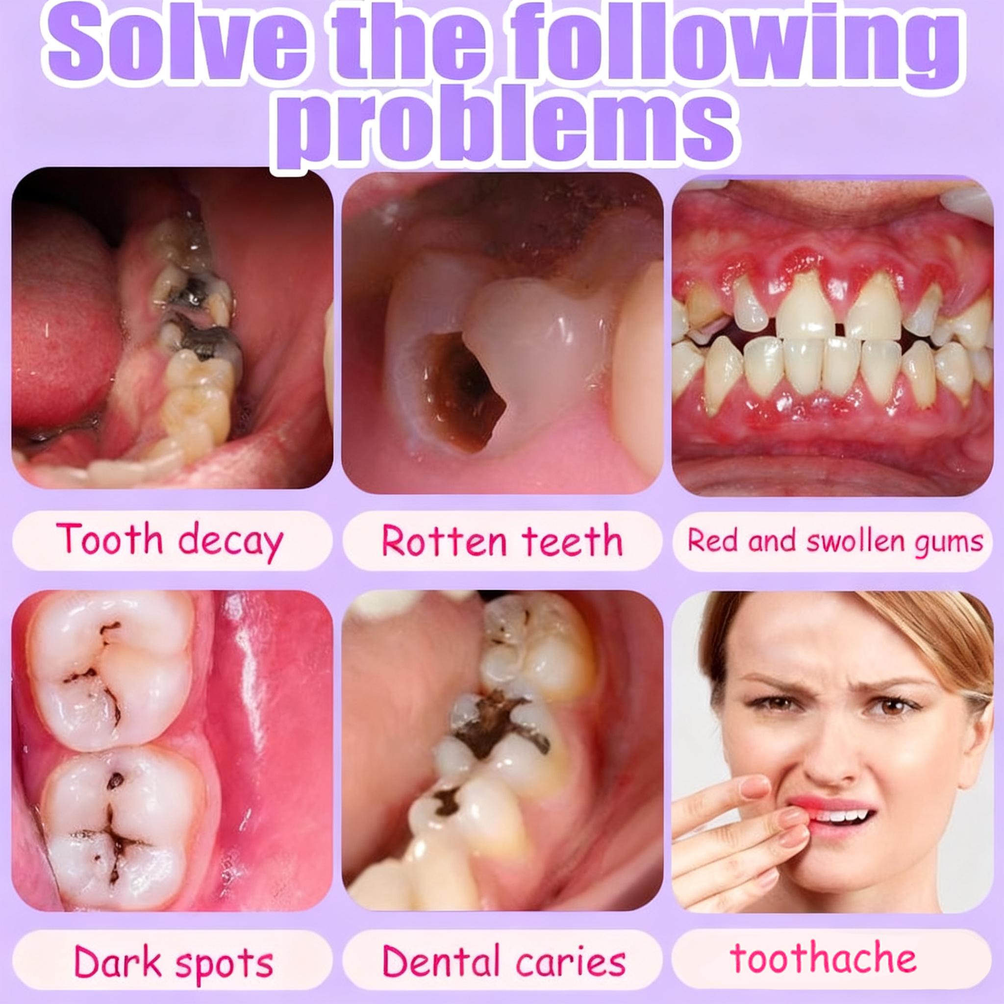 Sensitive Teeth Cavity Protection Toothpaste, Extra Strength Enamel Support, Professional Anti-Decay Formula, Soothing Mint for Fresh Breath & Gum Health, Daily Defense.