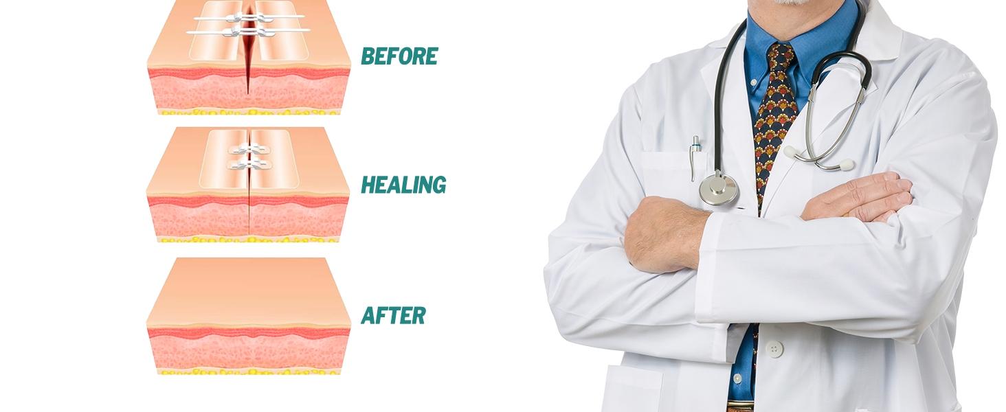 Sanke Rescue 14/28 Pack Wound Closure Strips Zipper Bandages Emergency Laceration Closure Kit Repair Wounds Closures Device