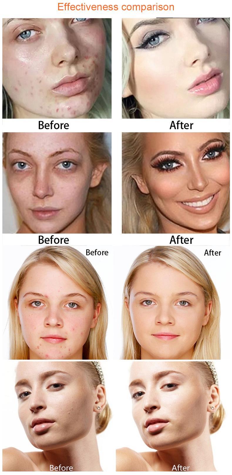 15 colors Skin-matching flawless liquid foundation, smart-toned face makeup that you can tint yourself Hypoallergenic, light, medium, medium coverage Semi-matte finish Hides wrinkles and fine lines Safe and lightweight for sensitive skin