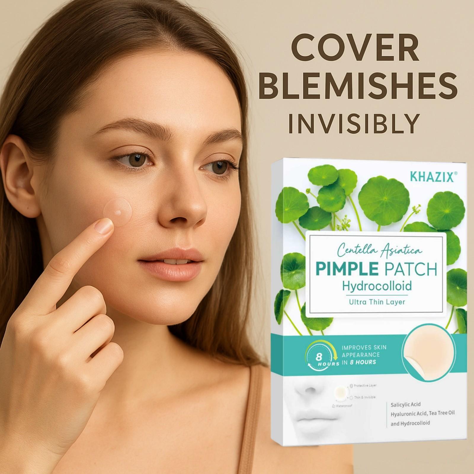 288pcs High-Quality Water Gel Patch, Concealer Patches & Covers, Gentle Non-Irritating, Waterproof Breathable, Essential Facial Skincare Product