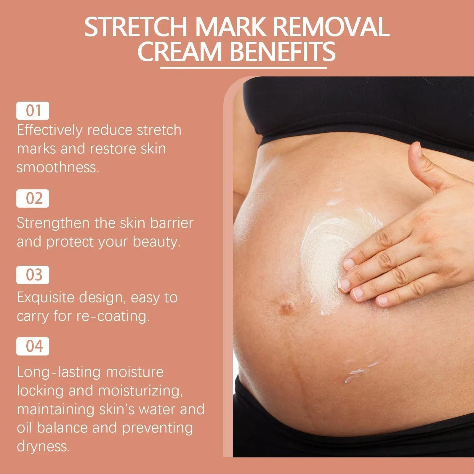 HOT SALE Stretch Marks Permanent Removal Eliminate Body Belly Stretch Marks Swelling Marks Remove Skin Cracks Repair Firming Car
