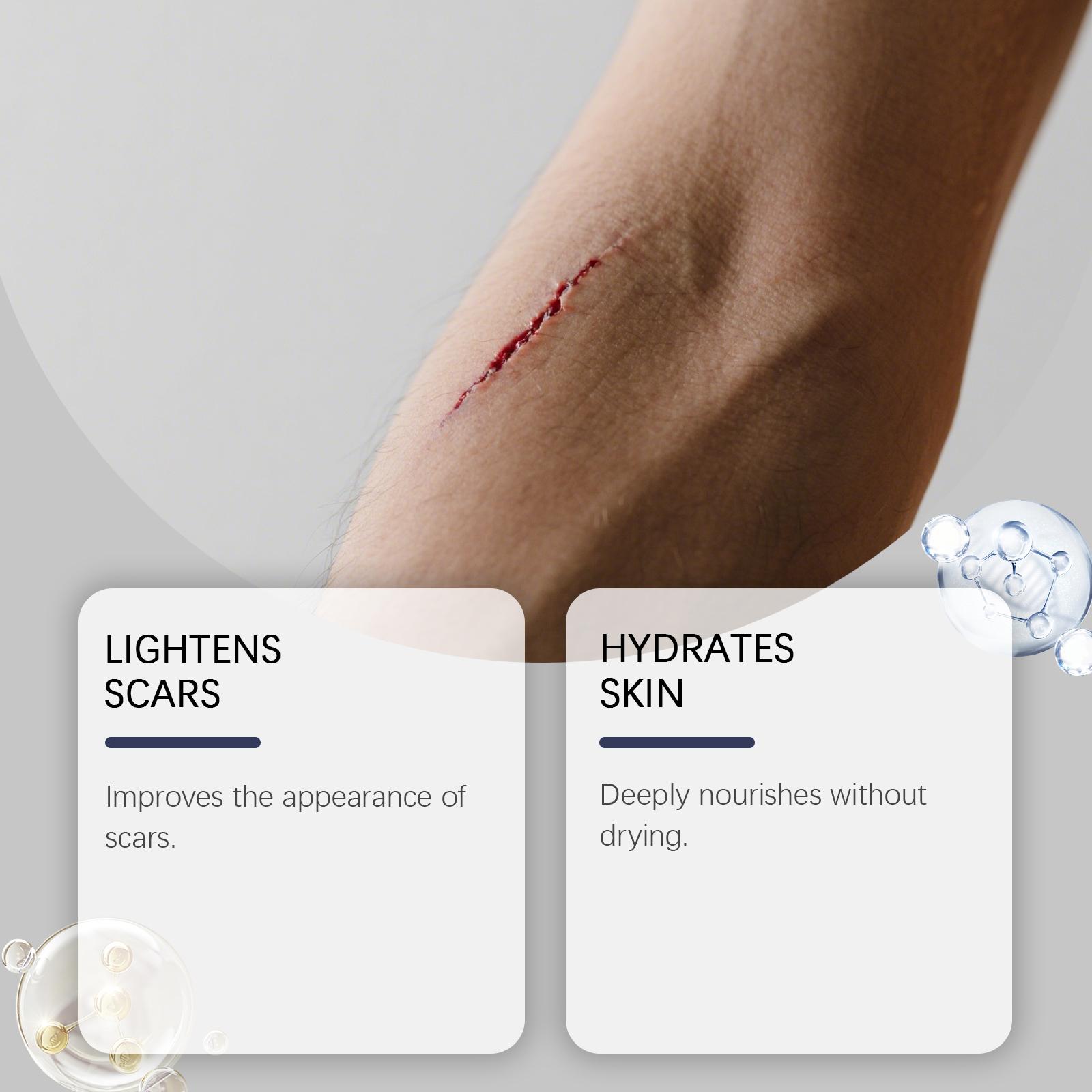 Skin Scar Moisturizing Care Stick, Nourishing Facial Body Skin Scar Appearance Smooth Soft Daily Care Cream, Essential Skincare Routine