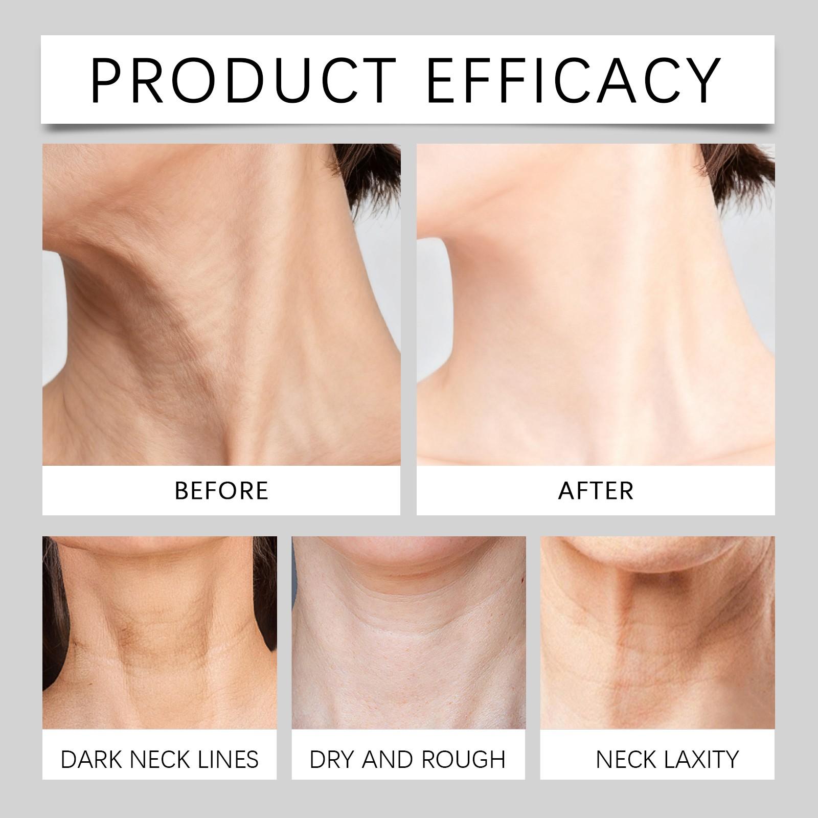 Neck Lifting Hydrating Cream, Anti-Wrinkle Neck Firming Balm, Wrinkle Reduction, Skin Tightening, Moisturizing Care for Neck Area