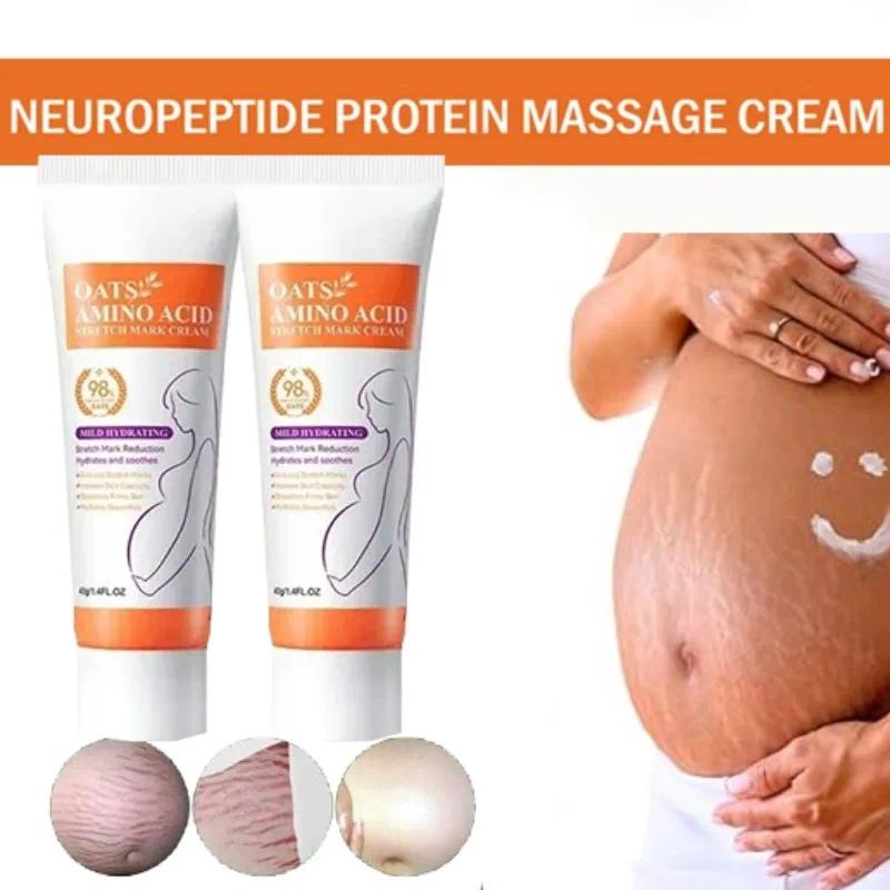 HOT SALE Stretch Marks Permanent Removal Eliminate Body Belly Stretch Marks Swelling Marks Remove Skin Cracks Repair Firming Car