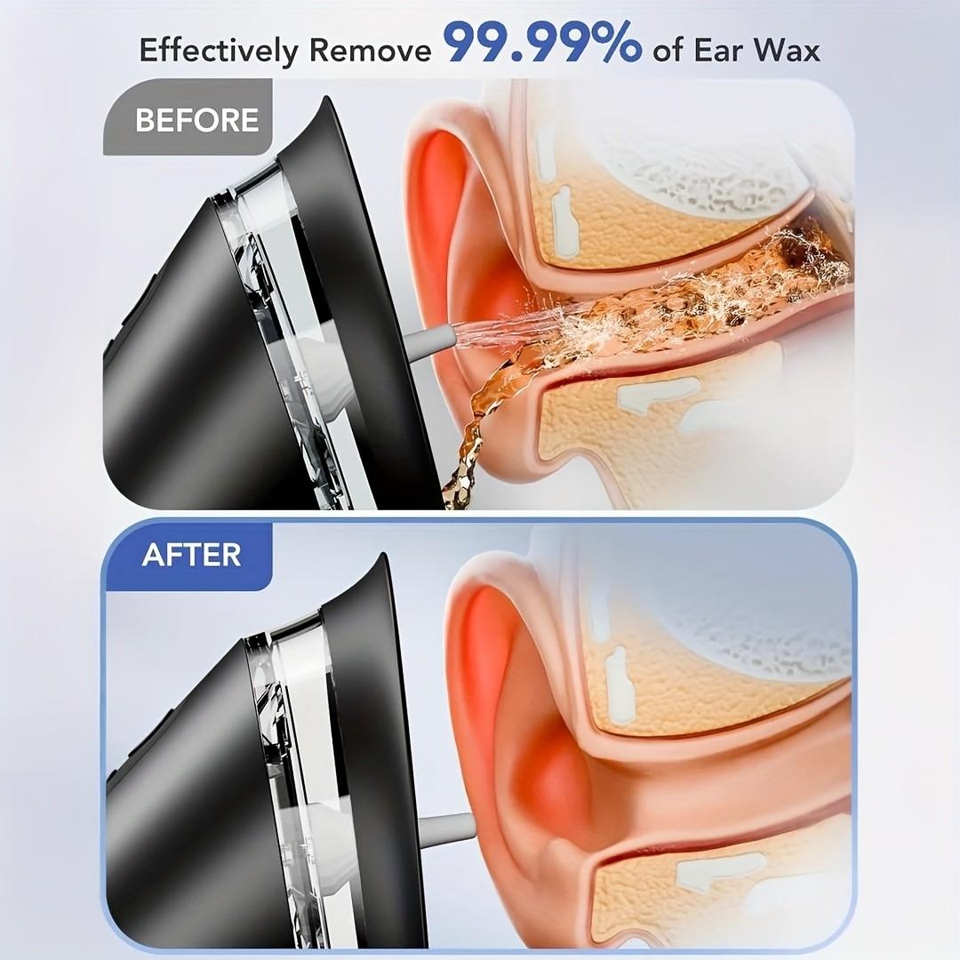 Professional Electric Earwax Removal System, 3-Gear Hydraulic Ear Cleaning Set with Water Temperature Sensor, Visible Waste Bin and USB Charging, Ear Cleaning Water Machine, Ear Irrigation System, Earwax Remover
