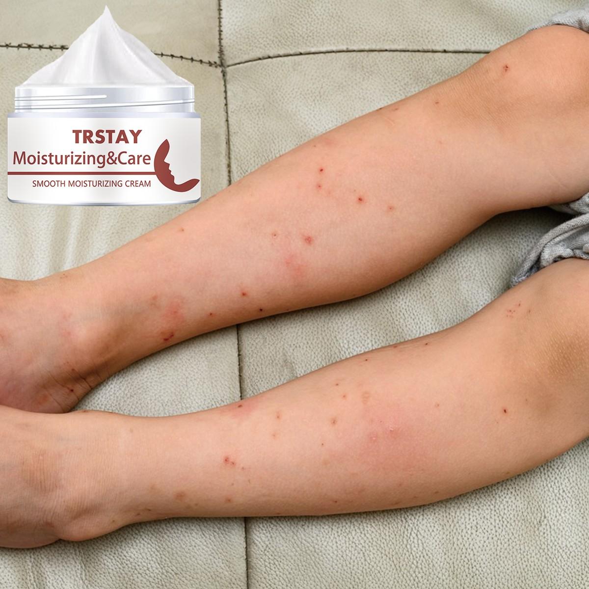 Trstay 5g-100g Smooth Moisturizing Body Cream, Soothes Sensitive Skin, Non-Greasy, Deep Hydration, Improves Roughness, Gift for Friends