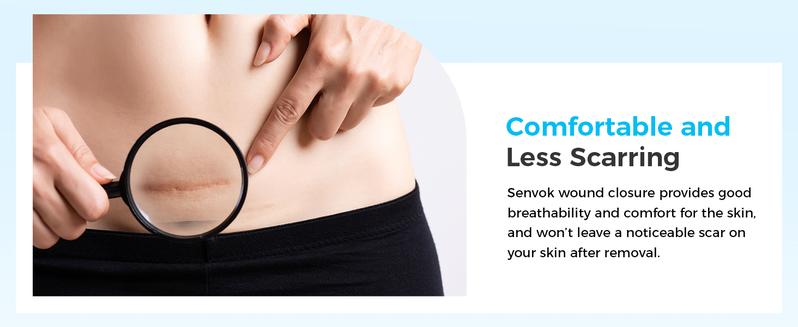 Senvok Butterfly Bandaids for Wound Closure, 2 Pcs Zip Stitch Wound Closure Strips, Surgical Laceration Repair Without Sew - Quick Clot - Emergency Wound Closures Device (PU)