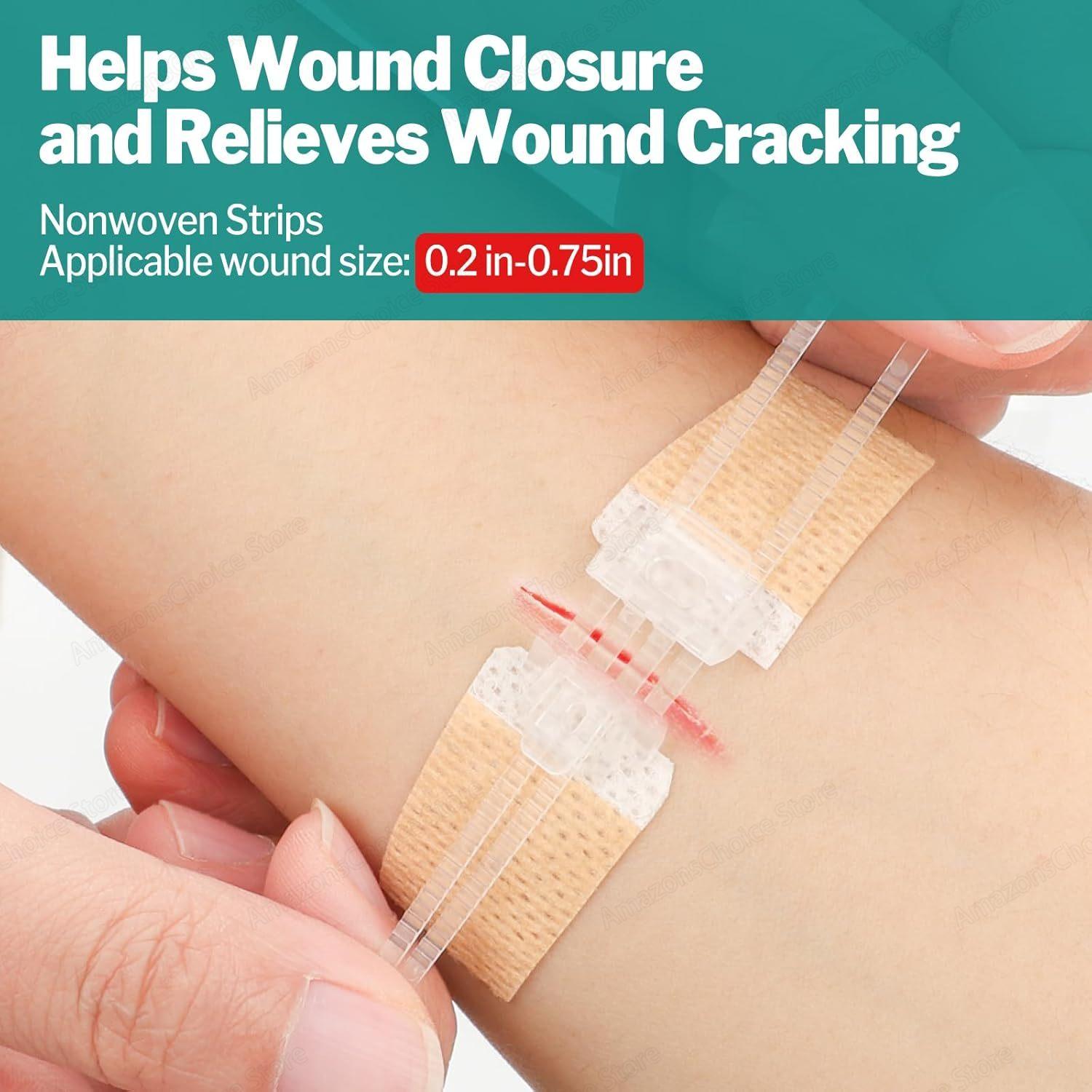 Sanke Rescue 14/28 Pack Wound Closure Strips Zipper Bandages Emergency Laceration Closure Kit Repair Wounds Closures Device