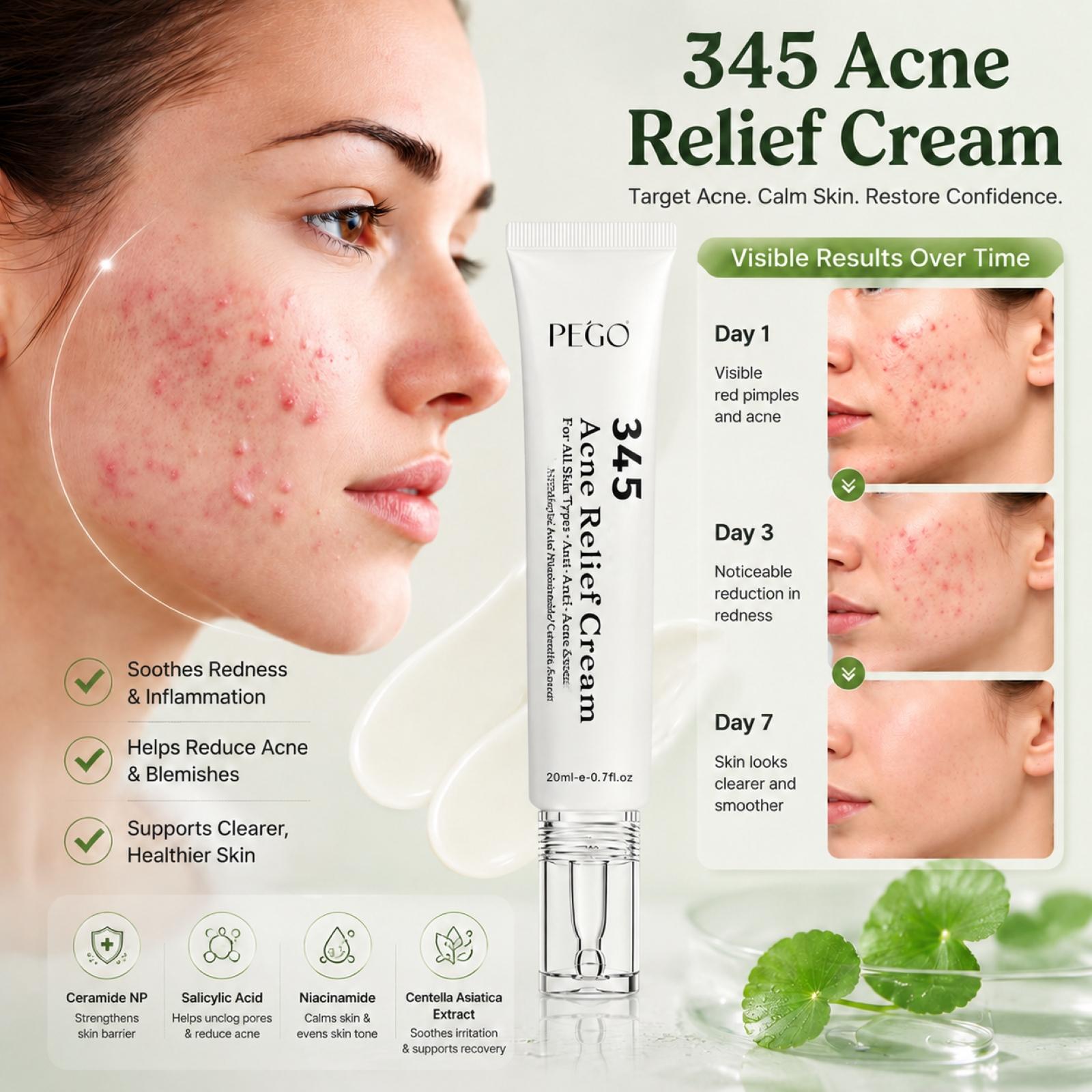 PEGO 345 Acne Relief Cream - Acne Solution Cream, Daily Face Moisturizer, Blemish Relief Care, Soothing Recovery, For Acne and Post-Acne Face Moisturizer with Centella,Salicylic Acid, Niacinamid,Calm Redness & Fade Acne Scars,Nighttime Acne Repair